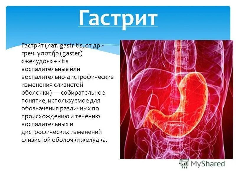 Гастрит биология. Презентация на тему хронический гастрит.