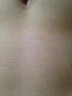 Желтые пятна признак