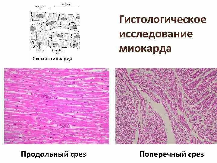 Миокард гистология. Миокард продольный срез. продольный срез гистология. окраска по гопф гистология миокарда.