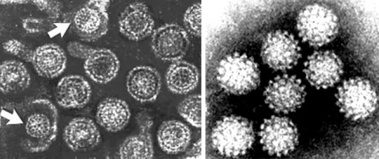 Вирус гепатита 6. Вирус гепатита под микроскопом. Вирус гепатита б под микроскопом. Вирус гепатита b gjl vb rhjcrjgjv. Микроскопия вирусного гепатита а.