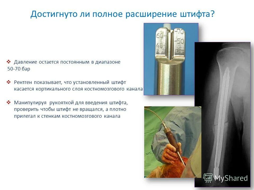 Проверить штифт. Диаметр штифта формула. Проверить штифт. Проверить штифт. Штифтовые и шпоночные соединения.