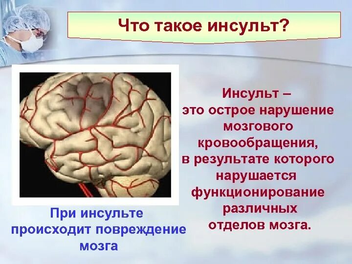 Инсульт картина. Острое нарушение мозгового кровообращения (ОНМК). Расстройства кровоснабжения головного мозга.