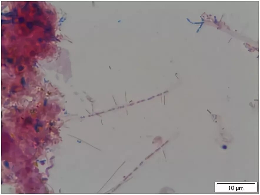 Лептотрикс лечение. Нитчатые бактерии (Sphaerotilus. Нитчатые микроорганизмы (Sphaerotilus, Leptothrix). Нитчатые железобактерии (Sphaerotilus, Leptothrix). Нитчатые микроорганизмы (Sphaerotilus, Leptothrix) под микроскопом.