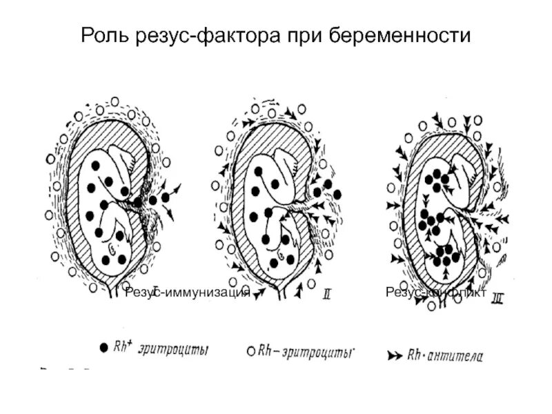 Механизм резус иммунизации. Резус фактор иммунизация. Резус-конфликт при беременности. Пути иммунизации по резус-фактору. Резус прививка