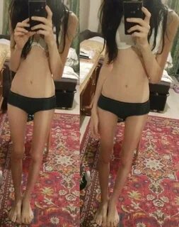 thinspo/ - Thinspo General 