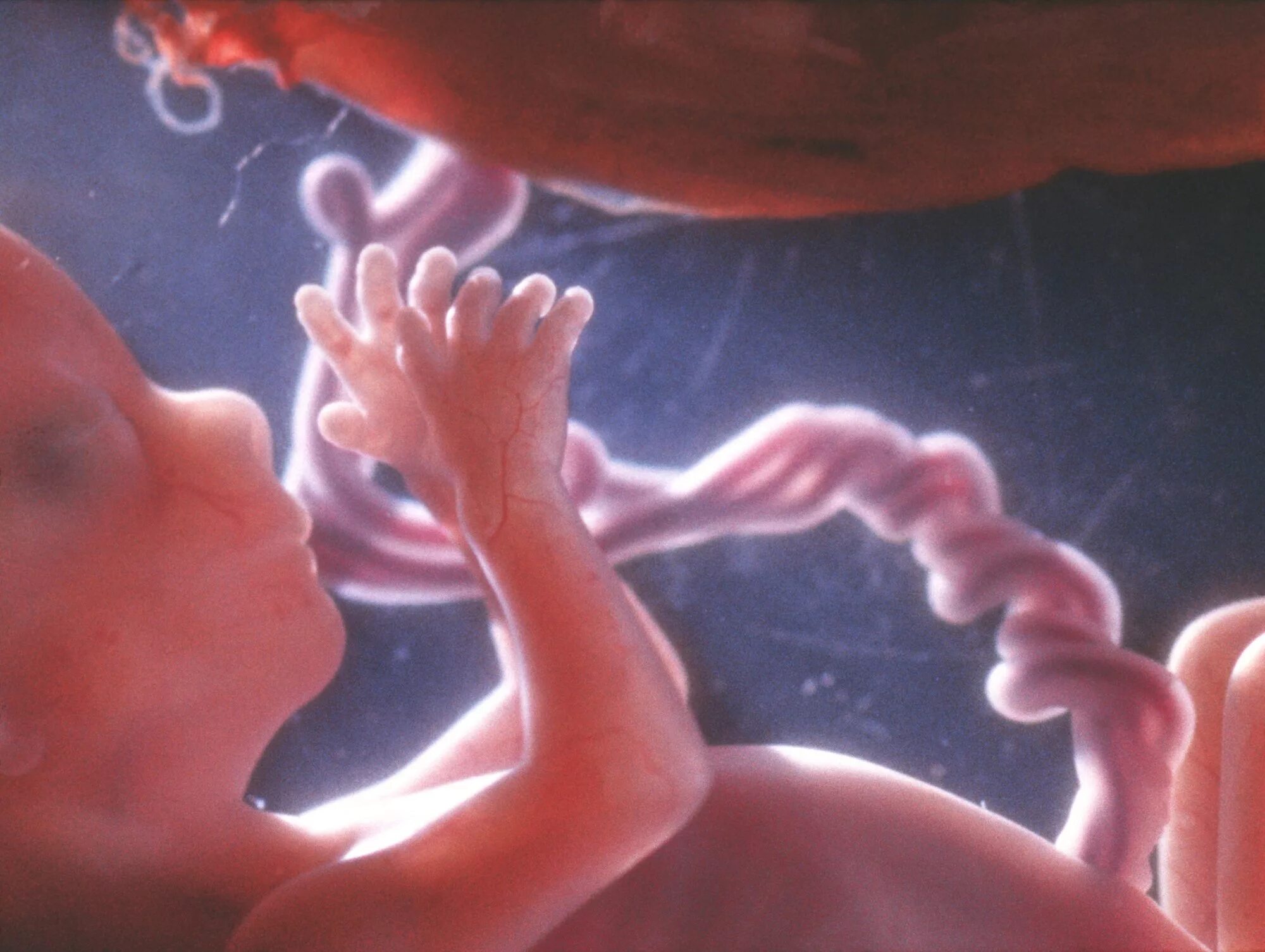 внезапный плод