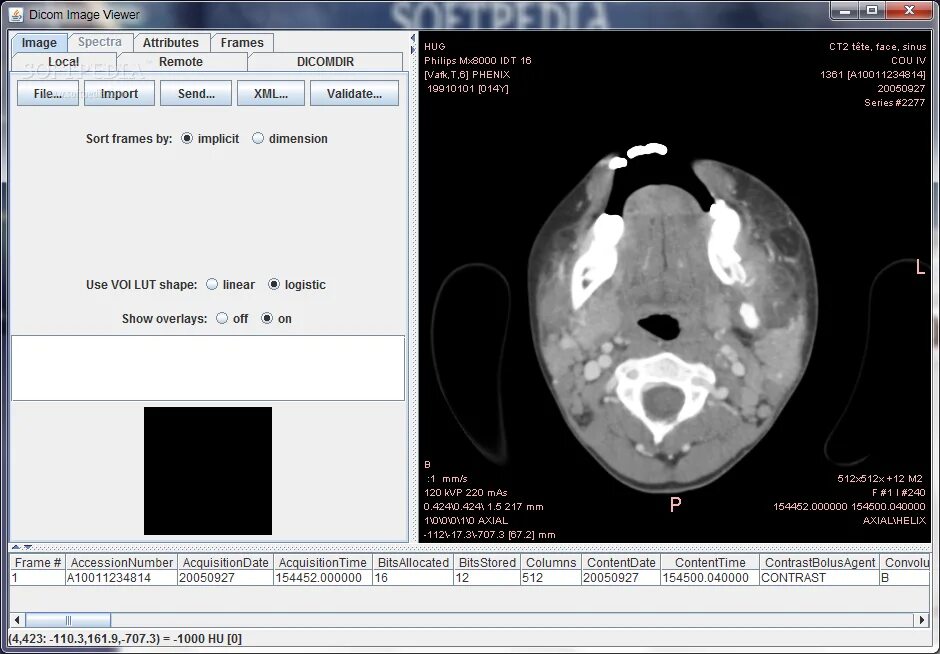 Dicom viewer. Изображение dicom. dicom image viewer. библиотека dicom изображений.