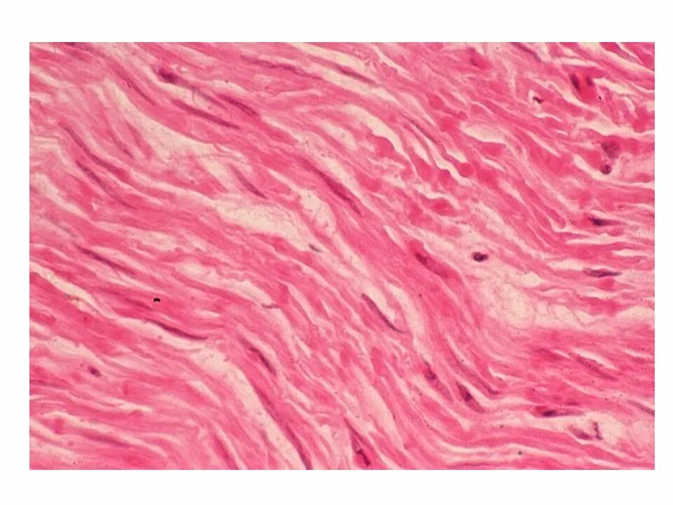 Гладкая мышечная ткань гистология. Гладкая мышечная ткань гистология препарат. Гладкая мышечная ткань срез стенки мочевого пузыря. Гладкая мышечная ткань срез тонкой кишки.