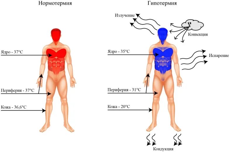 Температура 37 после переохлаждения. Гипотермия. Охлаждение тела человека. Температура тела при гипотермии. Температурная схема тела человека.