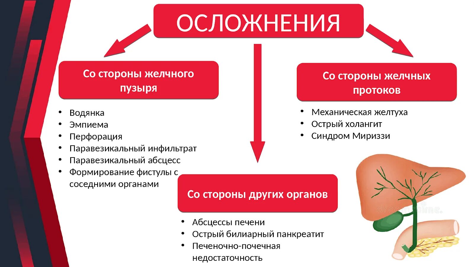 Осложнения. Осложнения при холецистите. Осложнения острого холецистита. Заканчиваться осложнение