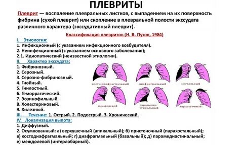 Плеврит код мкб