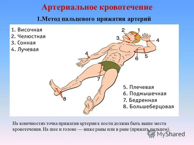 Артериальное кровотечение нижних конечностей. Остановка кровотечения точки прижатия. Точки прижатия артерий для остановки артериального кровотечения. Точки прижатия артерий для временной остановки кровотечения. Точки пальцевого прижатия для остановки артериального кровотечения.