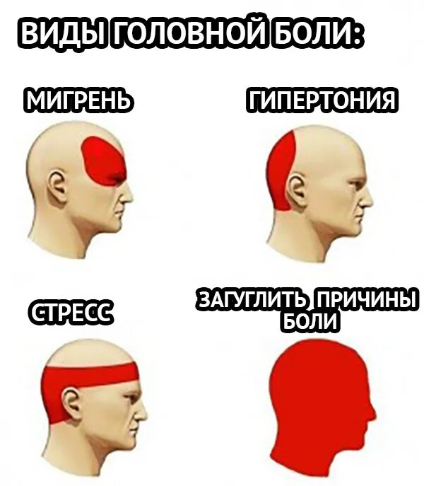 Что надо делать когда болит голова. Головная боль. Типы головной боли. Боль в голове. Причины головной боли.