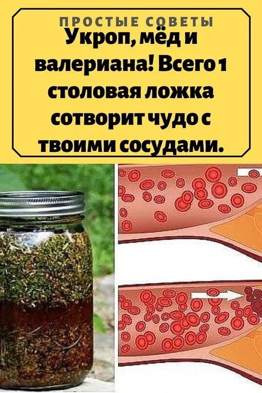 Укроп сосуды. Укроп мед валериана для сосудов. Укроп мёд и валериана для чистки сосудов. Укроп мед и валериана сотворят чудо с твоими сосудами. Укpoп, мёд, Вaлepиaнa.