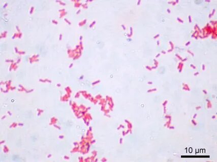 Enterobacteriaceae норма в мазке