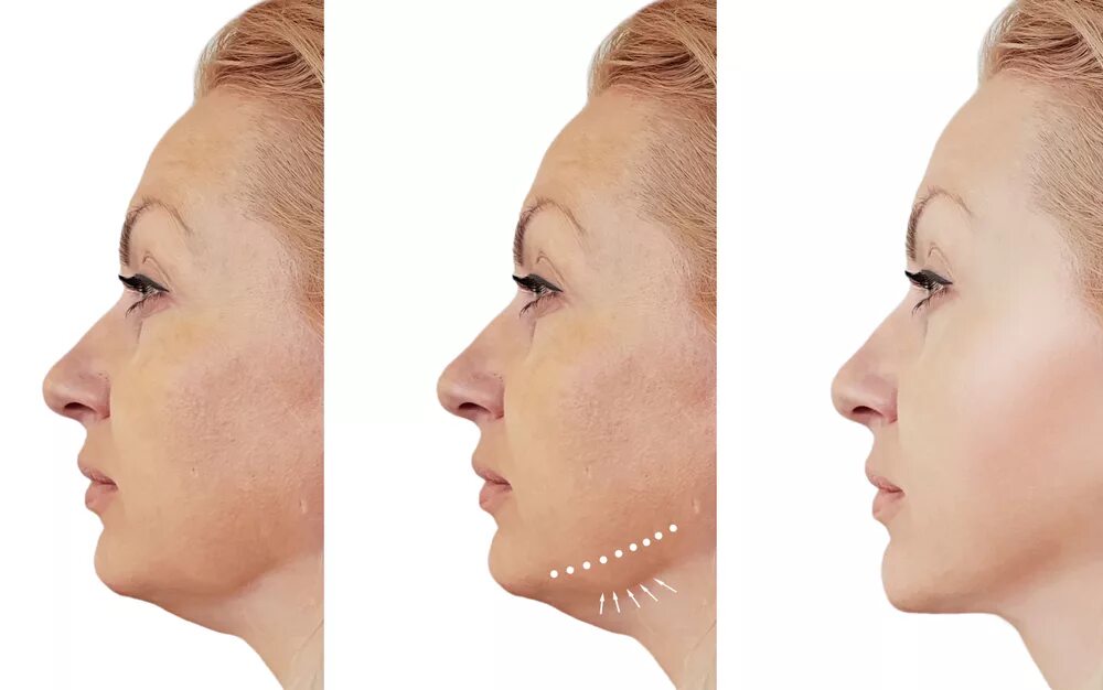 Home Reduce wrinkles, Plastic surgery, Dry skin problem