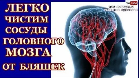 Сосуды головного средства