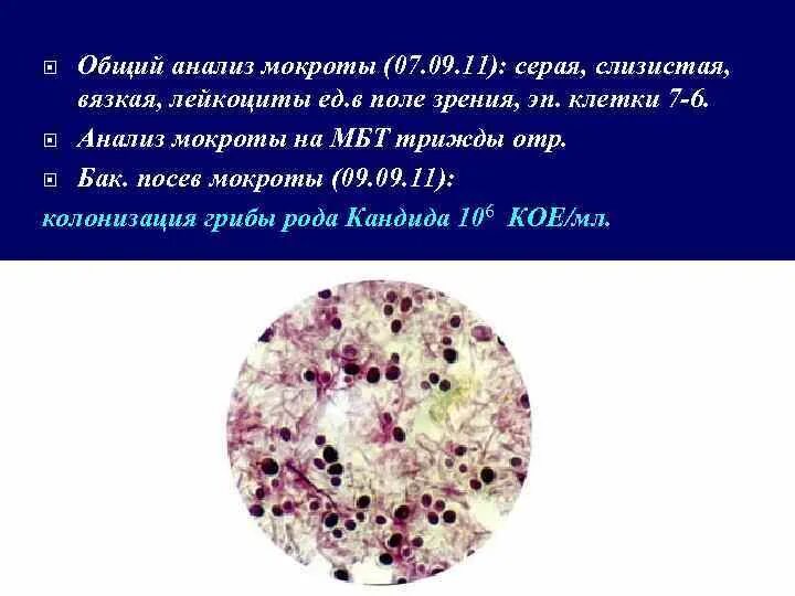 Мокрота на мбт. Исследование мокроты анализ. Общий анализ мокроты. Исследование лейкоцитов в мокроте. Исследование мокроты на общий анализ.