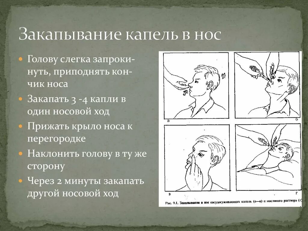 Закапывание в нос глаза уши. Алгоритм закапывания сосудосуживающих препаратов. Закапывание капель в нос алгоритм. Закапывание капель в глаза нос уши алгоритм. Введение капель в нос алгоритм.