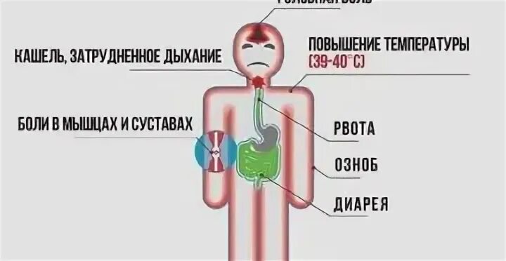 Болит голова и температура 37. Головная боль и температура. Симптомы пониженной температуры у человека. Симптомы при температуре 37.5