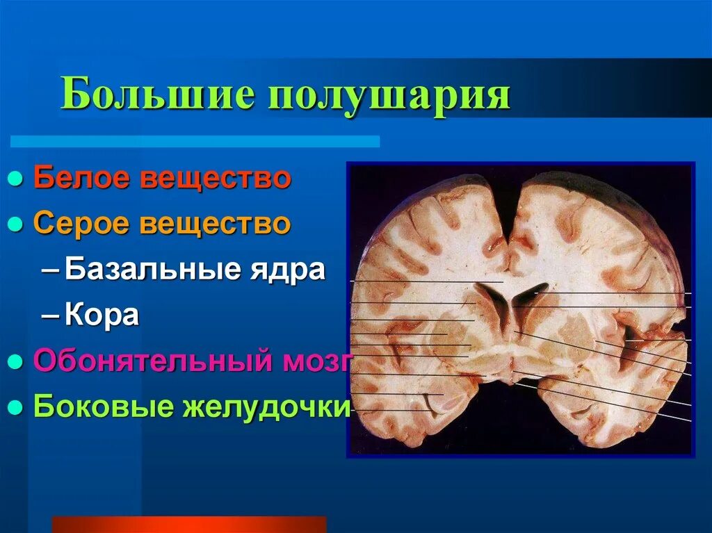 Подкорковые ядра полушарий. Серое вещество ядер больших полушарий. Подкорковые ядра серого вещества. Базальные ядра серого вещества. Серое вещество головного мозга (базальные ядра).