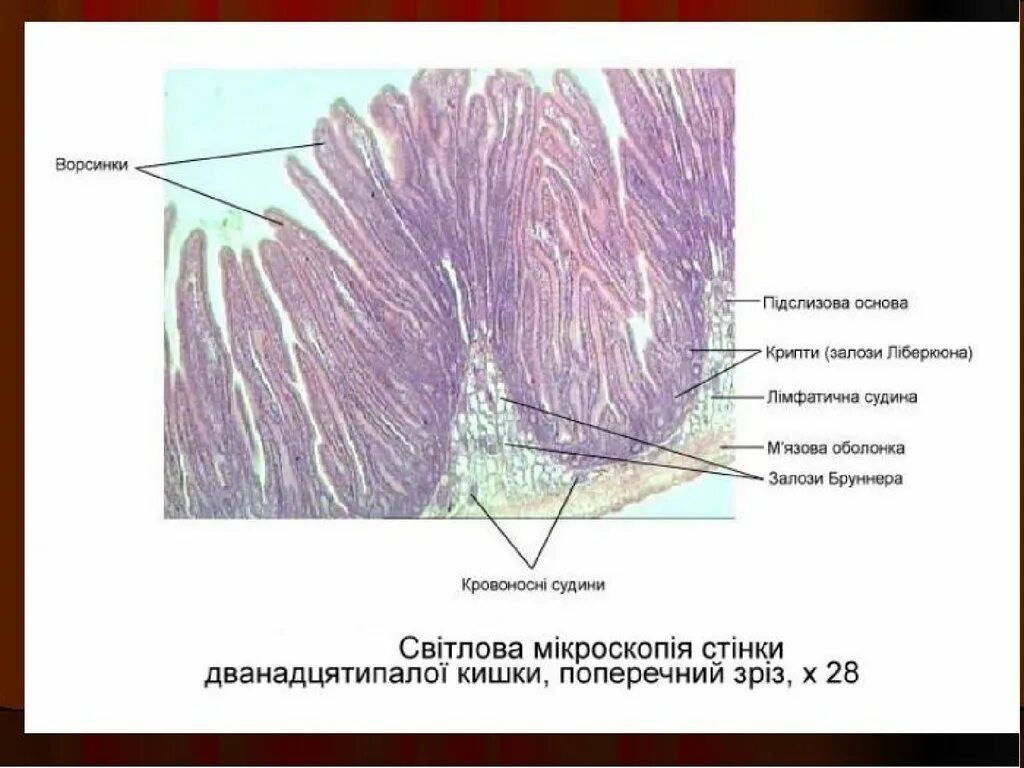 Крипты клетки. Система ворсинка крипта гистология. крипты и ворсинки гистология. система ворсинка крипта тонкая кишка. крипты двенадцатиперстной кишки.