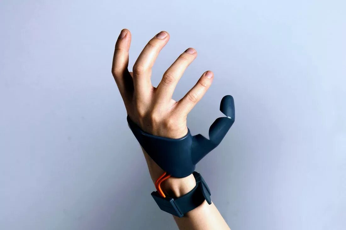 Протез большого пальца руки. Бионический протез пальца руки. Разработала пальчиком