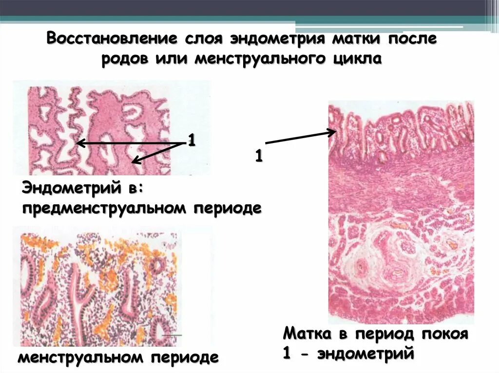 Восстановление эндометрия