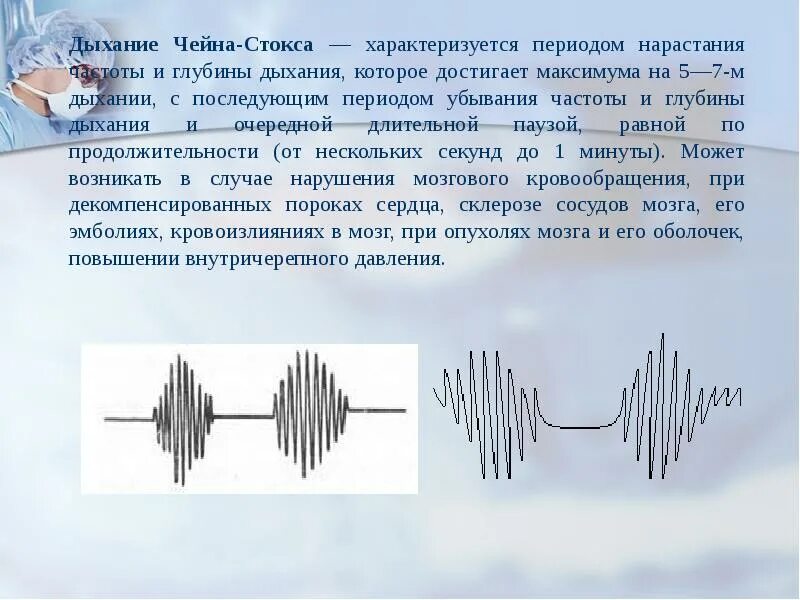 Дыхание Чейна Стокса. Дыхание Биота Чейна Стокса Куссмауля. Дыхание Чейна Стокса левитирацетам. Дыхание типа Чейна-Стокса.