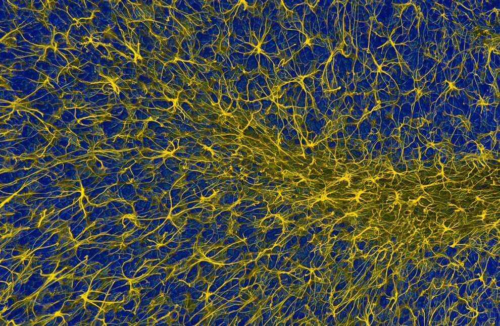 нервная ткань микрофотография. нервные клетки микрофотография. нервная клетки микротография. нейроны электронным микроскопом. нейроны мозга под микроскопом.