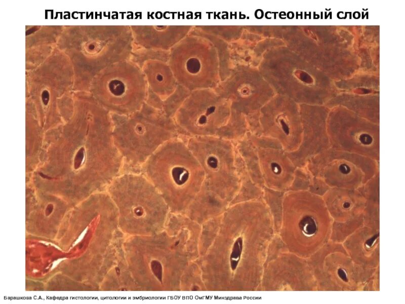 Пластинчатая кость. Костная пластинчатая соединительная ткань. Тонковолокнистая пластинчатая костная ткань. Пластинчатая костная ткань препарат гистология. Пластинчатая костная ткань микроскоп.