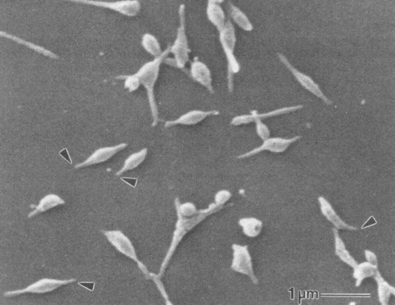 Микоплазма зев. Mycoplasma pneumoniae микроскопия. Mycoplasma pneumoniae микрофотография. Mycoplasma pneumoniae под микроскопом. Mycoplasma pneumoniae микробиология.