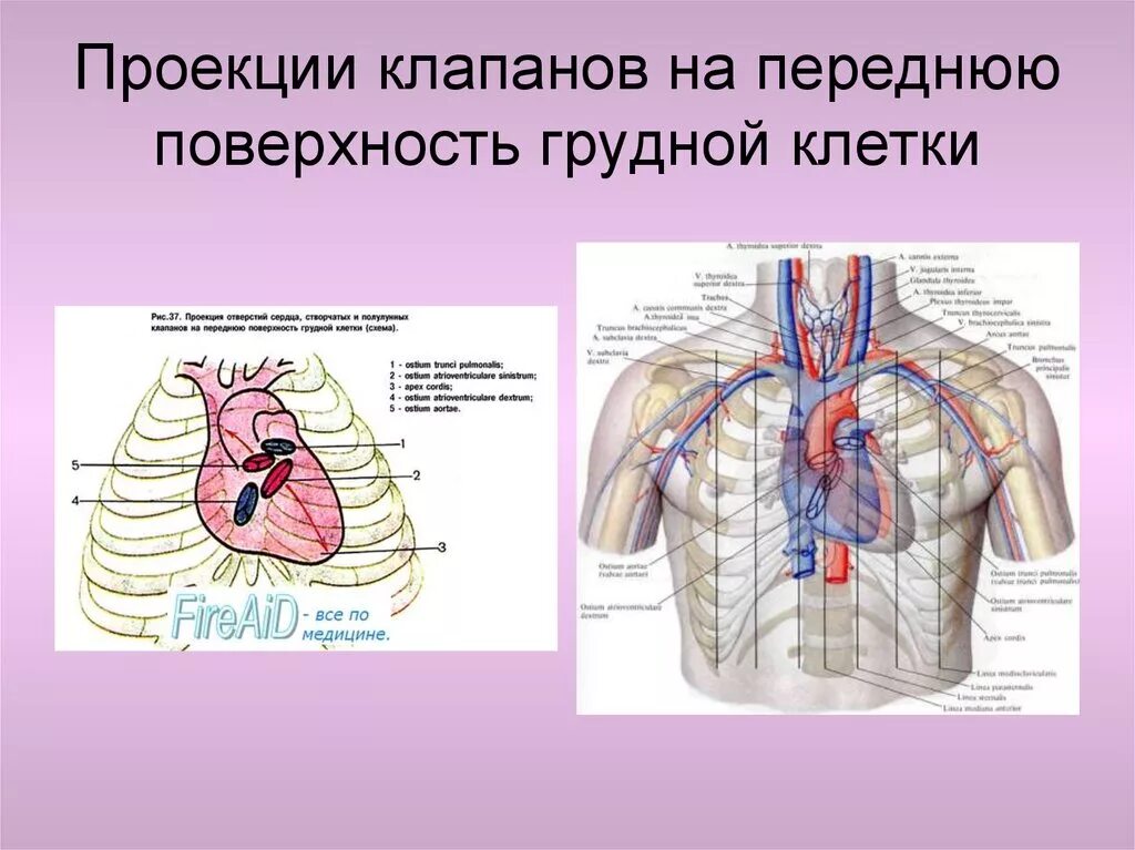 Проекция границ и клапанов сердца на грудную клетку. Проекция на поверхность грудной клетки сердце. Проекция границ сердца на поверхность грудной клетки. Проекция легочного клапана. Клапаны сердца на грудной клетке