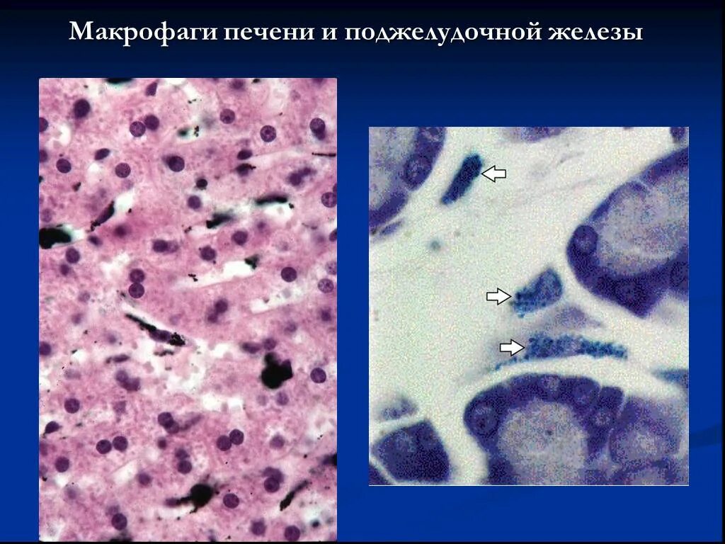 Макрофаги соединительной ткани. Макрофаги гистология. Печеночные макрофаги. Соединительная ткань в поджелудочной железе. Макрофаги в тканях