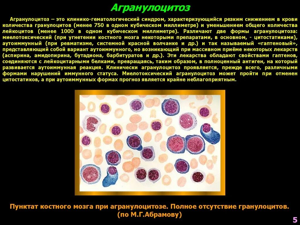 Агранулоцитоз лейкоцитарная формула. Агранулоцитоз картина крови. Агранулоцитоз это клинико-гематологический синдром. Агранулоцитоз лейкоформула. Патологические клетки крови не обнаружены