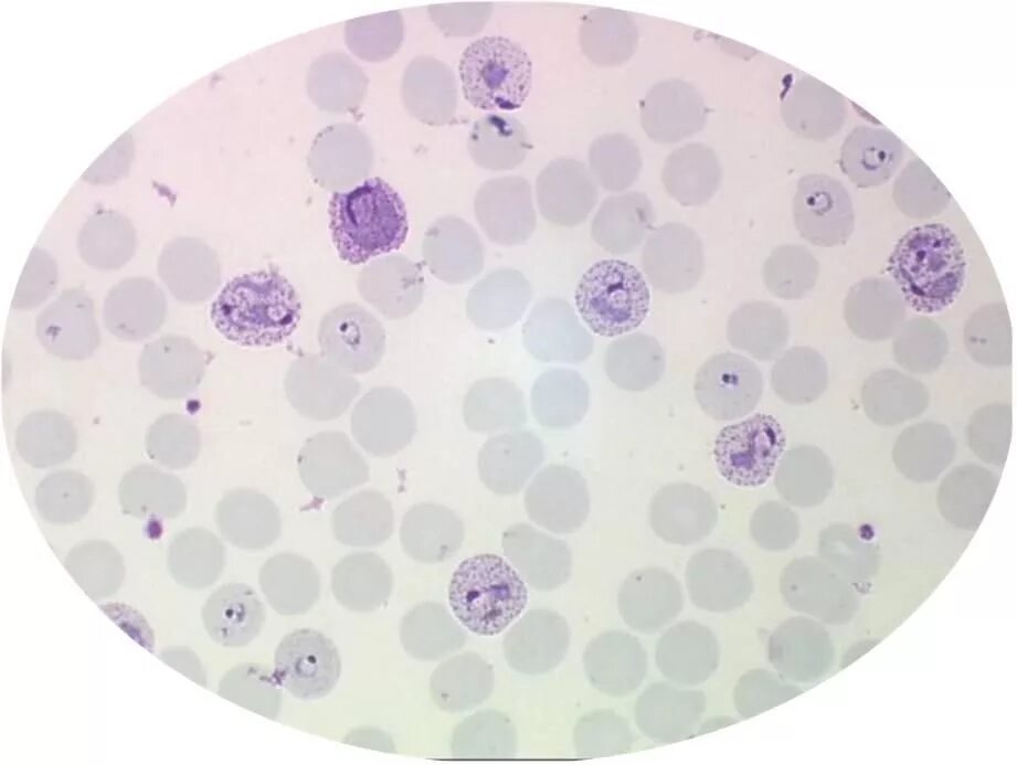 Малярия клетки. Малярийный плазмодий Вивакс. Малярийный плазмодий Plasmodium Vivax. Plasmodium falciparum трофозоит. Плазмодий Вивакс под микроскопом.