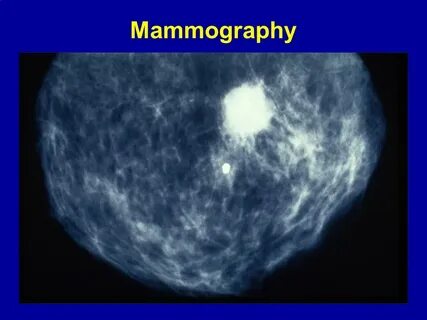 С 50.9 молочной железы