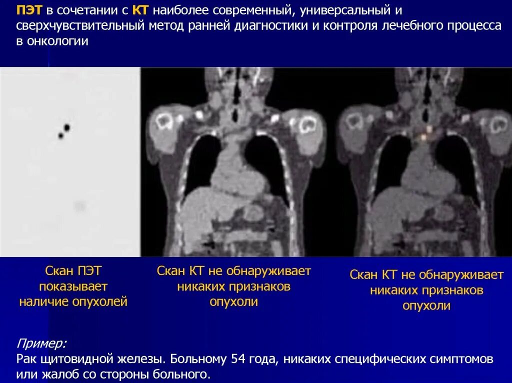 Что такое кт при онкологии