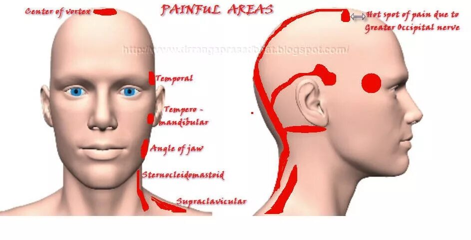 Neuralgia латынь