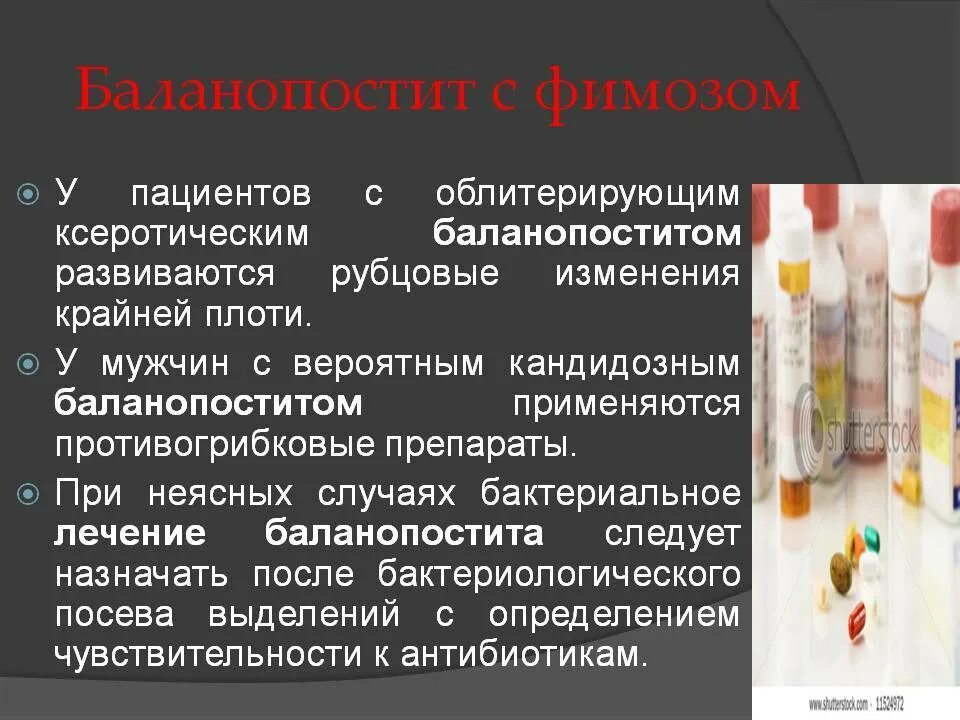 Чем лечить крайнюю плоть у мужчин. Воспалительные заболевания крайней плоти у мужчин. баланопостит при сахарном диабете. воспаление крайней плоти баланопостит.
