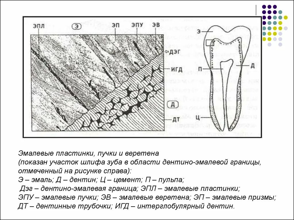 Эмалевые пучки и эмалевые веретена. Зуб эмаль дентин пульпа. Шлиф зуба гистология препарат. Эмалевые пучки эмалевые пластинки и эмалевые веретена это.