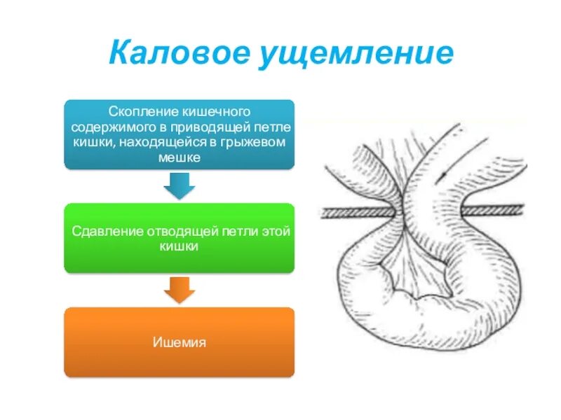 Вызов внешнего ущемления