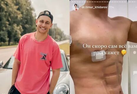 Давай после пластики