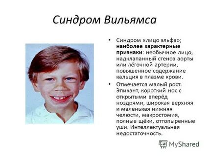 Почему у детей взрослые лица
