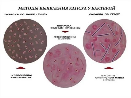 Бактерии способ