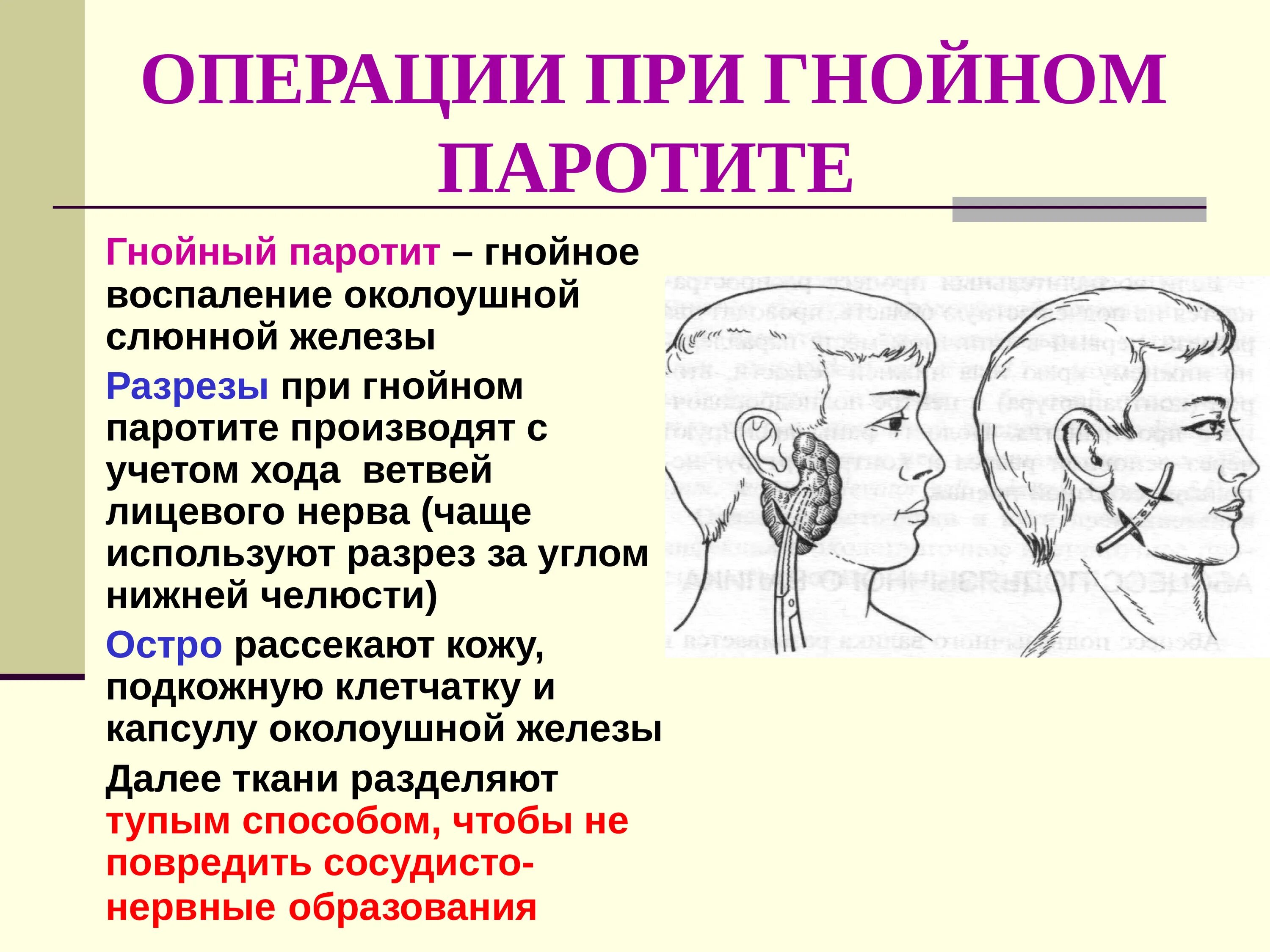 Разрезы при гнойных процессах околоушной слюнной железы. Операция при паротите топографическая анатомия. Разрезы при Гнойном паротите топографическая анатомия. Вскрытие Гнойного паротита топографическая анатомия. Операции околоушная железа