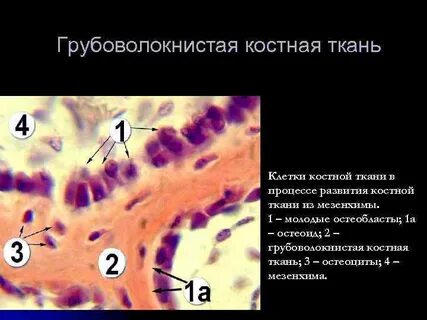 Грубоволокнистая костная ткань где