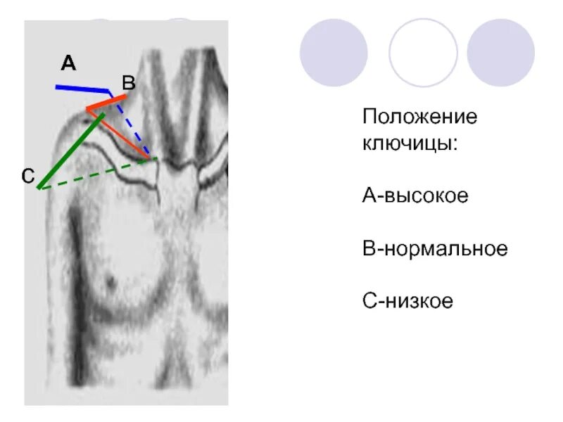Ключицы у девушек. Ключицы положение. Нормальное положение ключиц. Строение костей ключицы человека. Ключица анатомия человека.