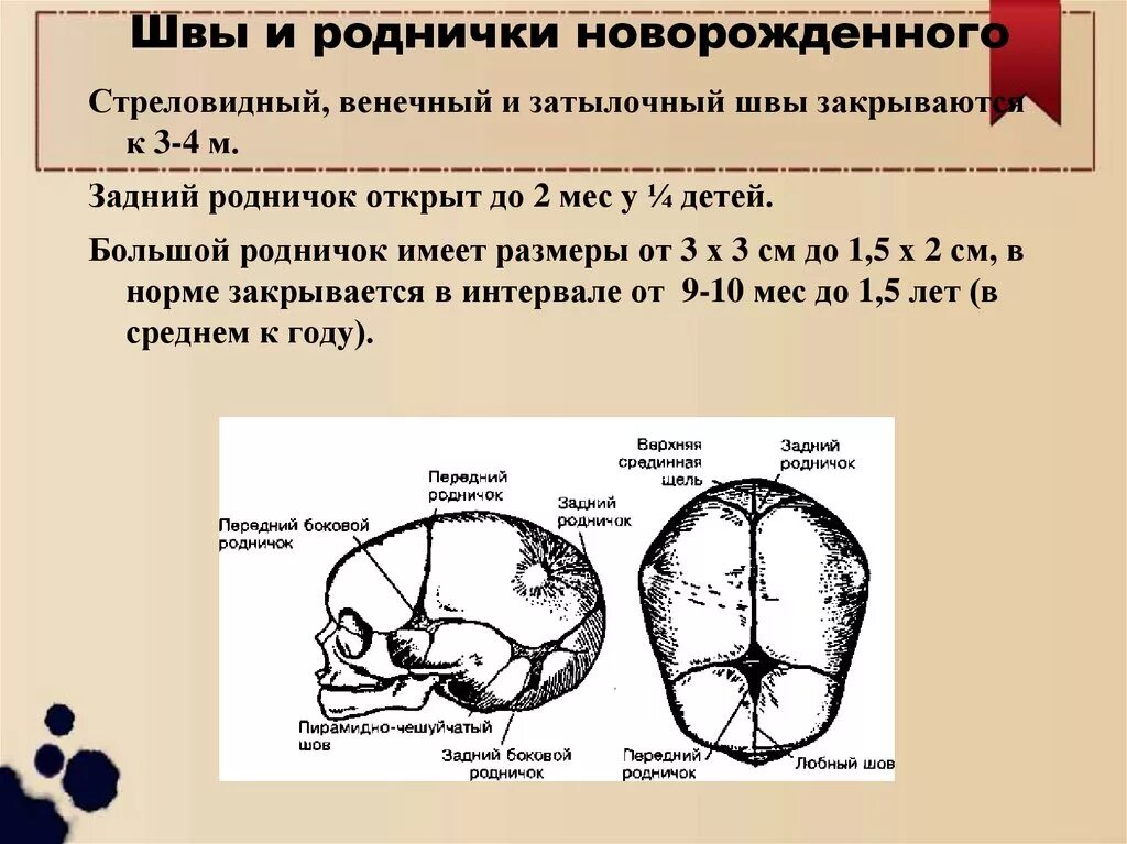 Роднички какие. Роднички черепа и сроки зарастания. Швы черепа у новорожденного в норме. Стреловидный шов черепа новорожденного норма. Закрытие большого родничка в норме.