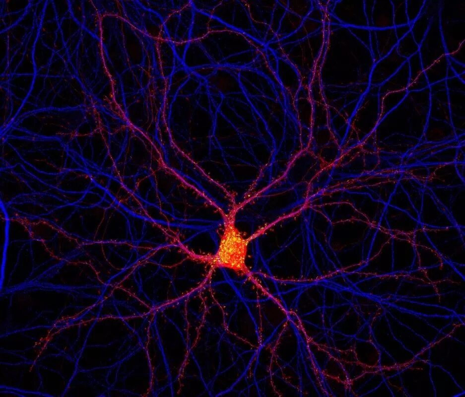 Нейронная система. Нейроны мозга. Нейронная клетка. Нейронные клетки головного мозга.
